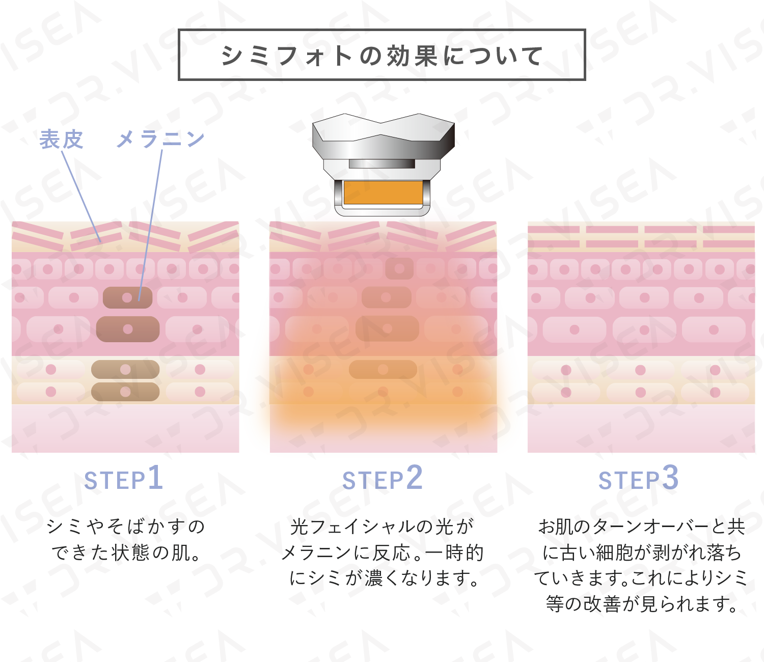 ダウンロード