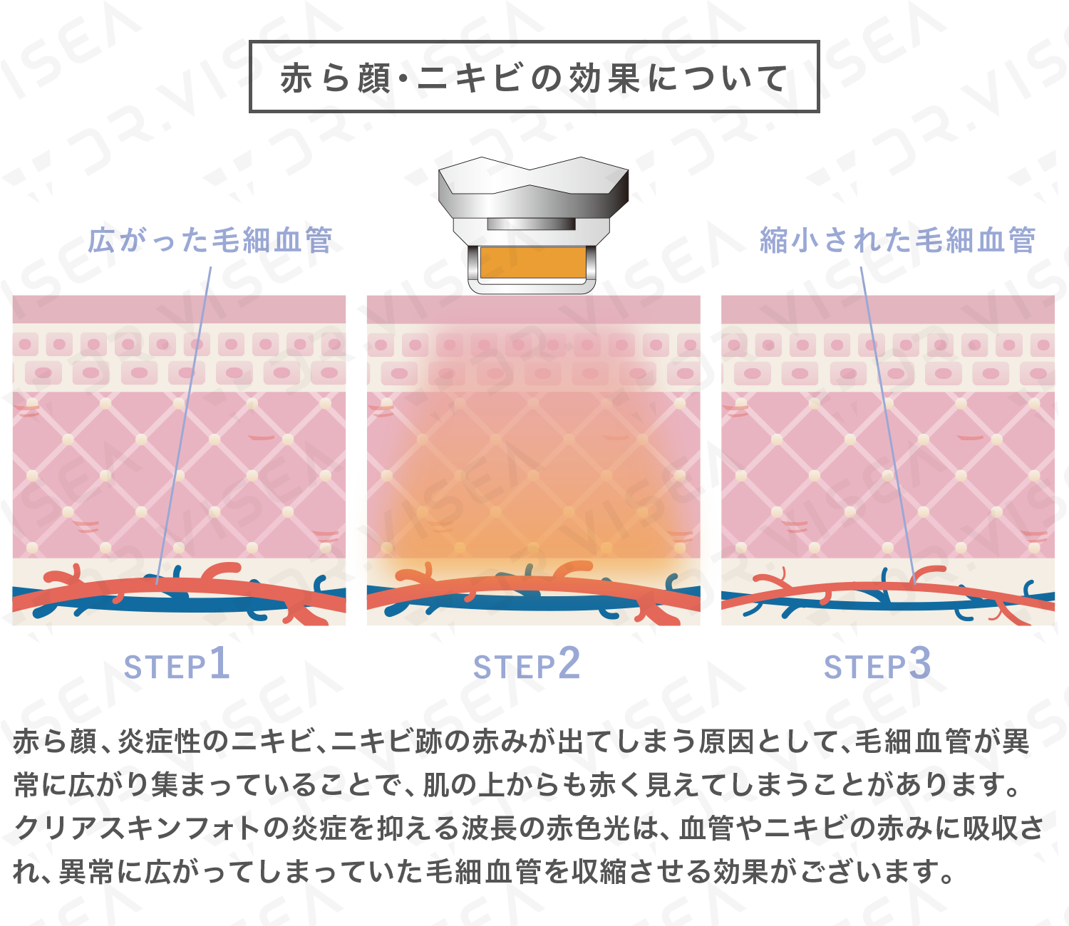 ダウンロード